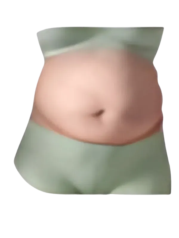 Sobrepeso